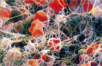Fibrin-Eiweißnetz
